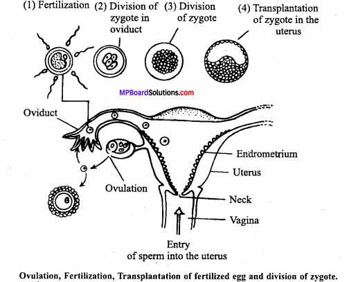 MP Board Class 12th Biology Important Questions Chapter 3 Human Reproduction 13